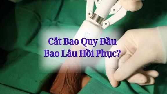 Sau Cắt Bao Quy Đầu Bao Lâu Thì Lành? Kiêng Gì Để Mau Hồi Phục?