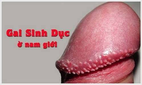 Gai Sinh Dục Ở Nam và Nữ: Lành Tính Hay Nguy Hiểm? Phân Biệt Với Sùi Mào Gà