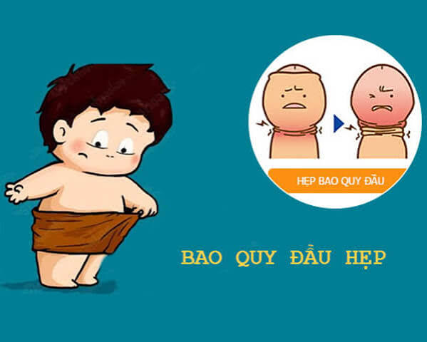 Hẹp Bao Quy Đầu Có Tự Khỏi Không Hay Bắt Buộc Phải Can Thiệp Y Tế?